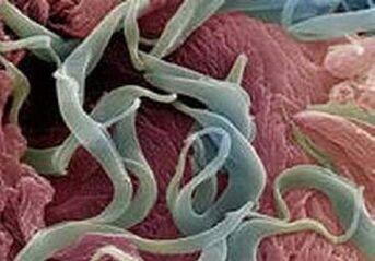 Příznaky a léčba parazitů v lidském těle