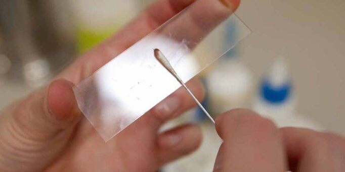 škrábání kůže pro parazity