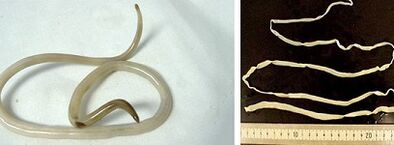 druhy parazitů v lidském těle