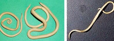 jaké parazity může mít člověk